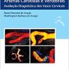 ECO-DOPPLER das Artérias Carótidas e Vertebrais: Avaliação Diagnóstica dos Vasos Cervicais (Original PDF from Publisher)
