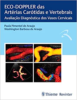 ECO-DOPPLER das Artérias Carótidas e Vertebrais: Avaliação Diagnóstica dos Vasos Cervicais (Original PDF from Publisher)