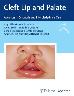 Cleft Lip and Palate: Advances in Diagnosis and Interdisciplinary Care (Portuguese Edition) (EPUB)