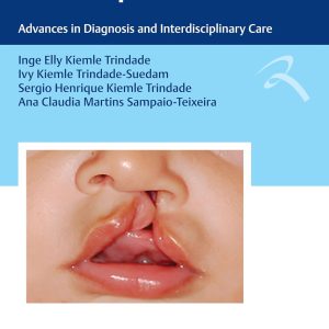 Cleft Lip and Palate: Advances in Diagnosis and Interdisciplinary Care (Portuguese Edition) (EPUB)