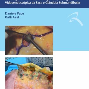 Guia de Dissecção Anatômica em Cadáveres Frescos com Foco em Cirurgia da Face: Abordagem da Técnica de Deep Plane, Cirurgia Videoendoscópica da ace e Glândula Submandibular (Portuguese Edition) (EPUB)