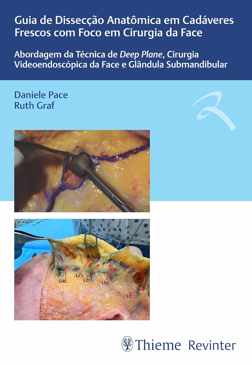 Guia de Dissecção Anatômica em Cadáveres Frescos com Foco em Cirurgia da Face: Abordagem da Técnica de Deep Plane, Cirurgia Videoendoscópica da ace e Glândula Submandibular (Portuguese Edition) (EPUB)