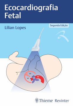 Ecocardiografia Fetal (Portuguese Edition) (EPUB)
