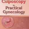 Colposcopy in Practical Gynecology (EPUB)