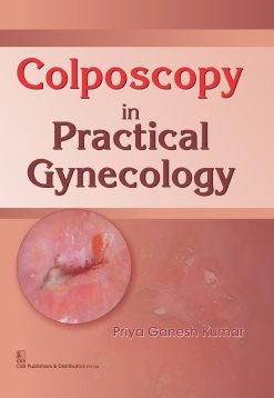 Colposcopy in Practical Gynecology (EPUB)