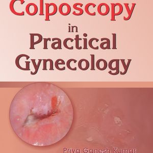 Colposcopy in Practical Gynecology (EPUB)