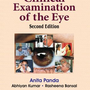 Clinical Examination of the Eye, 2nd Edition (EPUB)