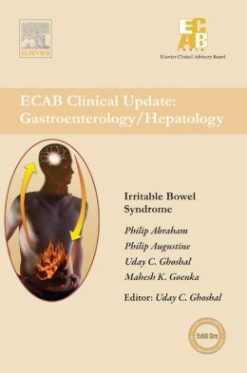 Irritable Bowel Syndrome – ECAB