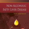 Non-Alcoholic Fatty Liver Disease – ECAB