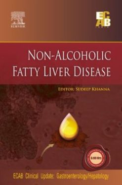 Non-Alcoholic Fatty Liver Disease – ECAB