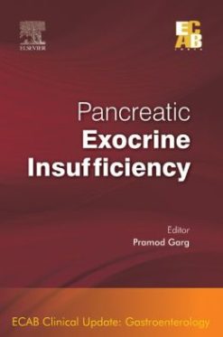 Pancreatic Exocrine Insufficiency – ECAB