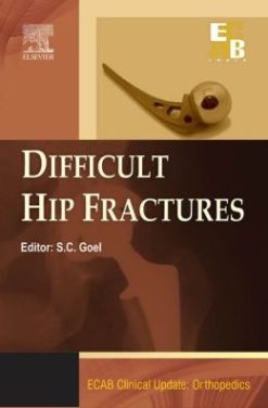 Difficult Hip Fracture – ECAB