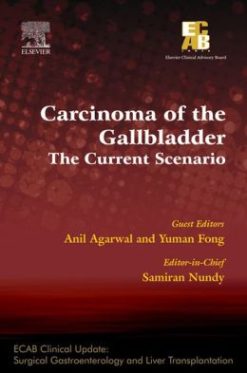 Carcinoma of the Gallbladder: The Current Scenario – ECAB