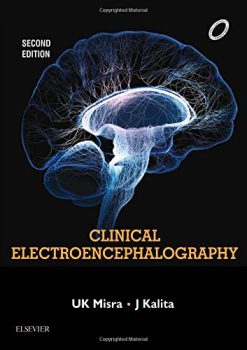 Clinical Electroencephalography, 2e (True PDF)