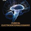 Clinical Electroencephalography, 2e (ePub)