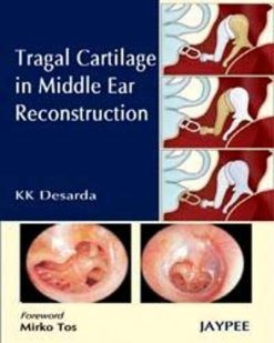 Tragal Cartilage in Middle Ear Reconstruction (Converted PDF)