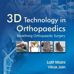 3D Technology in Orthopedics (Original PDF from Publisher)