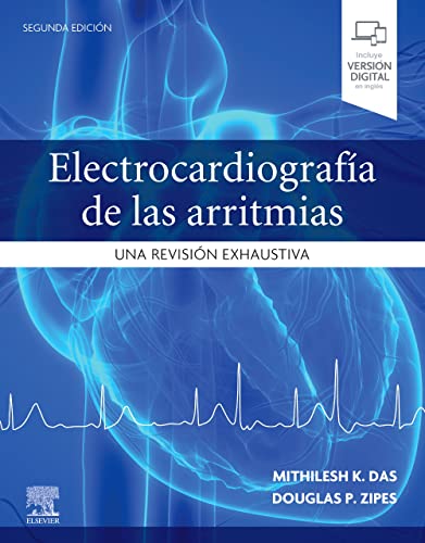 Electrocardiografía de las arritmias: Una revisión exhaustiva, 2nd edition (Original PDF from Publisher)