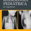 Radiología pediátrica en urgencias (Original PDF from Publisher)