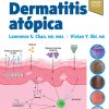 Dermatitis atópica (Original PDF from Publisher)