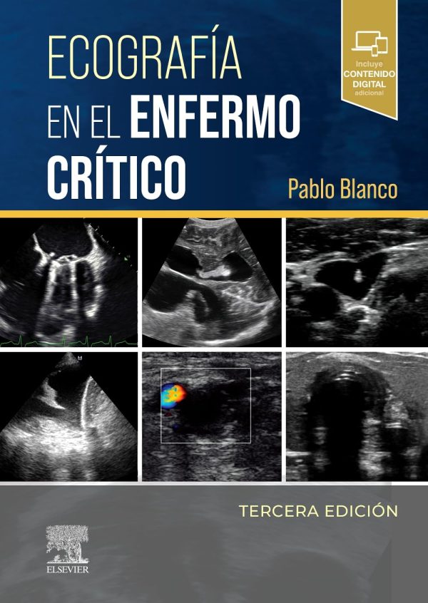 Ecografía en el enfermo crítico, 3rd Edition (Original PDF from Publisher)