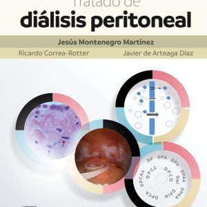 Tratado de diálisis peritoneal, 4th Edition (Original PDF from Publisher)