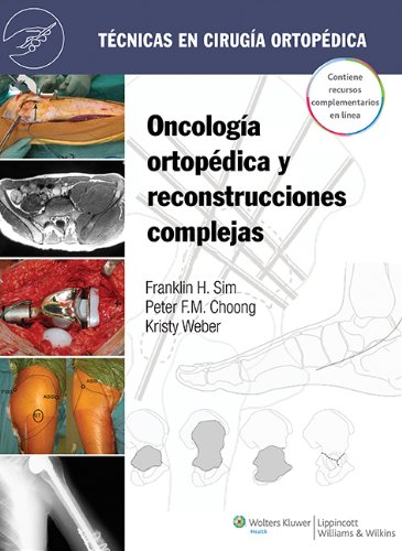 Técnicas en cirugía ortopédica. Oncología ortopédica y reconstrucciones complejas (Spanish Edition) (Original PDF from Publisher)
