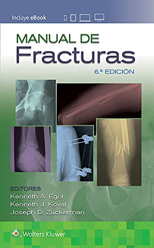 Manual de fracturas, 6ºEd (High Quality Image PDF)