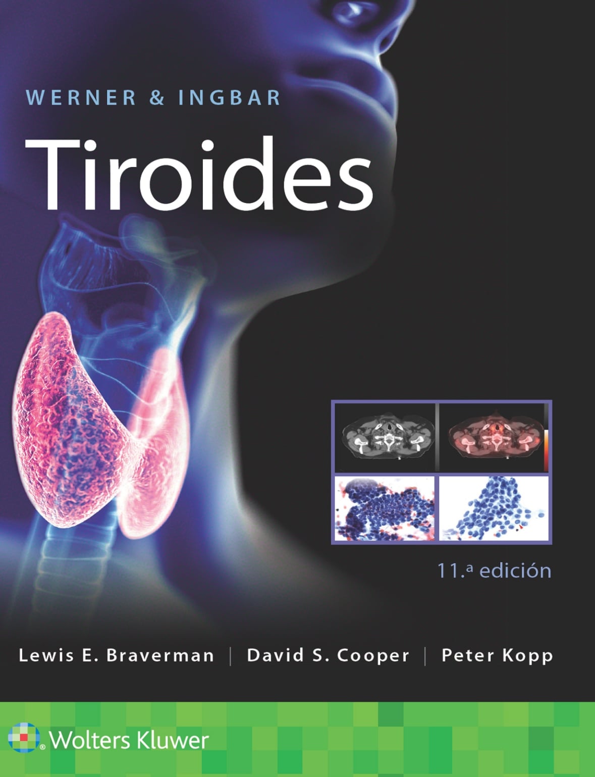 Werner & Ingbar. Tiroides, 11th edition (Original PDF from Publisher)