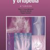Manual de traumatología y ortopedia (Spanish Edition), 8th Edition (Original PDF from Publisher)