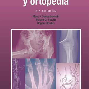 Manual de traumatología y ortopedia (Spanish Edition), 8th Edition (Original PDF from Publisher)