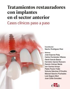 Tratamientos restauradores con implantes en el sector anterior. Casos clínicos paso a paso. (EPUB)