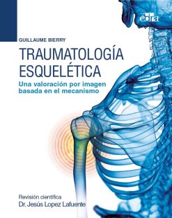 Traumatología esquelética Una valoración por imagen basada en el mecanismo (EPUB)