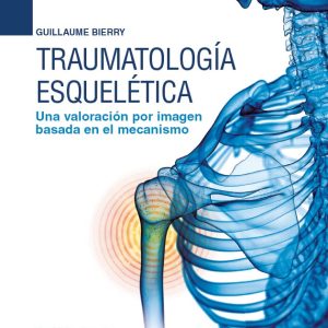 Traumatología esquelética Una valoración por imagen basada en el mecanismo (EPUB)