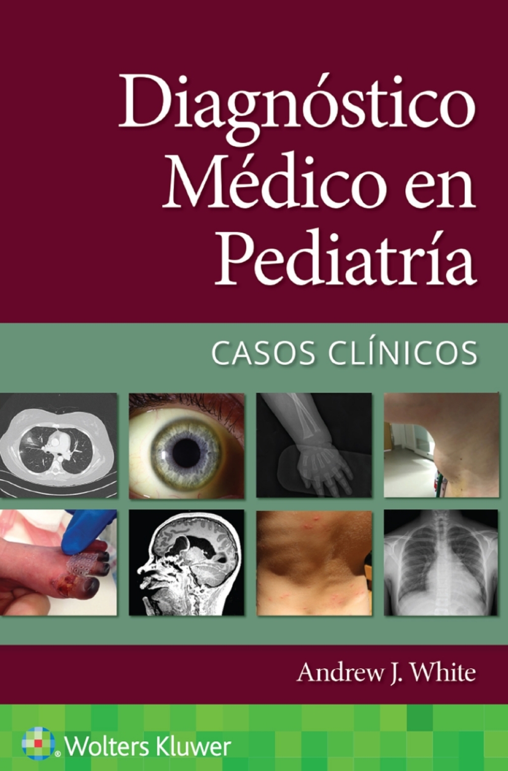 Diagnóstico médico en pediatría. Casos clínicos (Original PDF from Publisher)