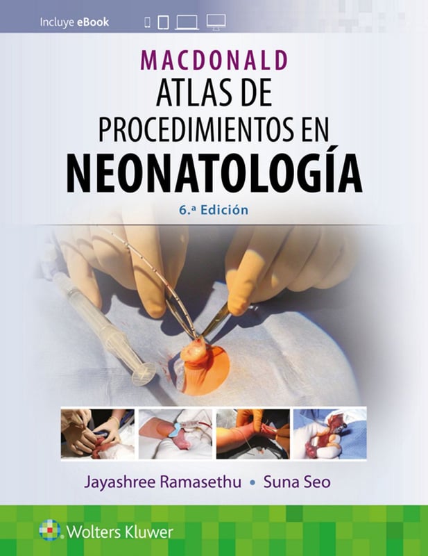 MacDonald. Atlas de procedimientos en neonatología, 6th edition (Original PDF from Publisher)