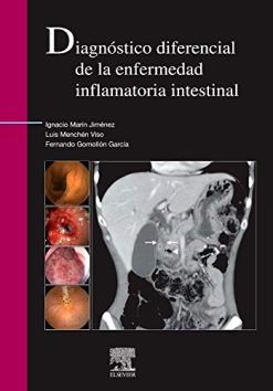 Diagnóstico diferencial de la enfermedad inflamatoria intestinal (Spanish Edition) (Original PDF from Publisher)