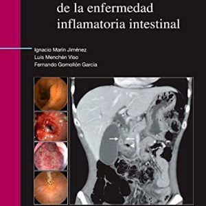 Diagnóstico diferencial de la enfermedad inflamatoria intestinal (Spanish Edition) (Original PDF from Publisher)