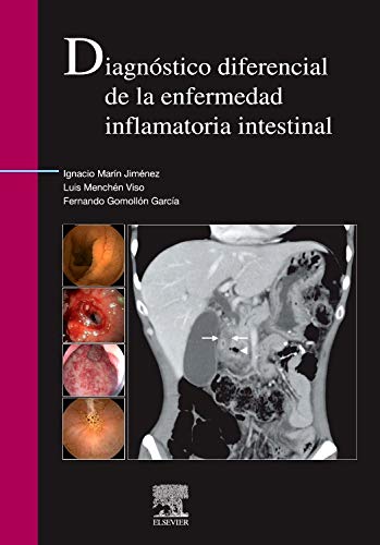 Diagnóstico diferencial de la enfermedad inflamatoria intestinal (Spanish Edition) (Original PDF from Publisher)