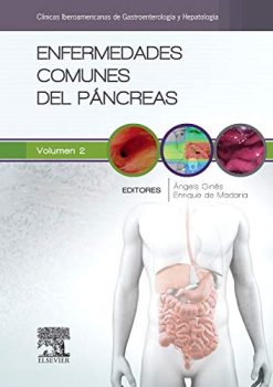 Enfermedades comunes del páncreas (Spanish Edition) (True PDF)