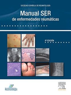 Manual SER de enfermedades reumáticas, 6e