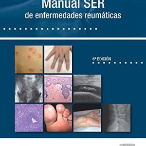 Manual SER de enfermedades reumáticas, 6e