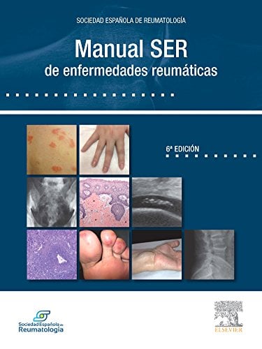 Manual SER de enfermedades reumáticas, 6e