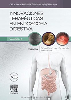 Innovaciones terapeuticas en endoscopia digestiva