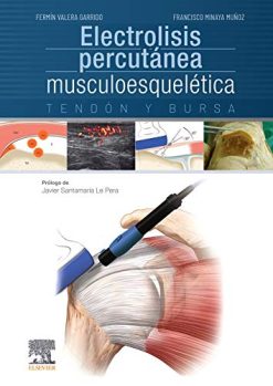 Electrolisis percutánea musculoesquelética. Tendón y bursa (Spanish Edition) (Original PDF from Publisher)