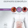 Esofagitis eosinofílica: Clínicas Iberoamericanas de Gastroenterología y Hepatología vol. 5