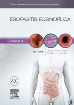 Esofagitis eosinofílica: Clínicas Iberoamericanas de Gastroenterología y Hepatología vol. 5