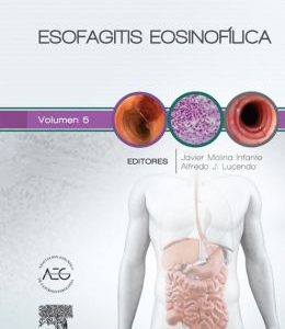 Esofagitis eosinofílica: Clínicas Iberoamericanas de Gastroenterología y Hepatología vol. 5