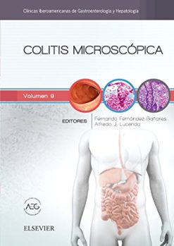 Colitis microscópica (Spanish Edition) (True PDF)