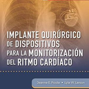IMPLANTE QUIRURGICO DE DISPOSITIVOS PARA LA MONITORIZACION
